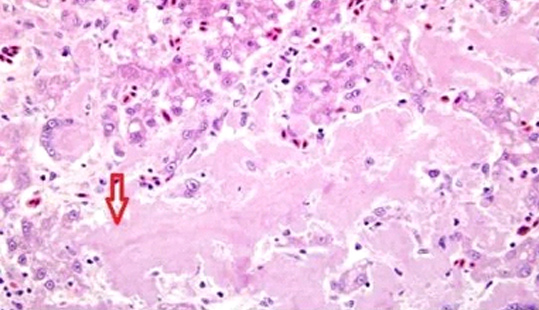 �������� | �������״��Ѫ����Ϥ����������